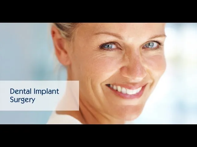 Dental Implants Explained